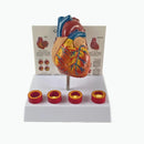 Simulering Avtagbar Anatomisk Människolivsstorlek Hjärta Kardiovaskulär anatomi Trombotisk Vaskulär medicinsk modell
