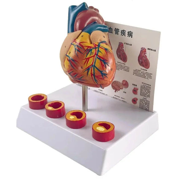 Simulação anatômica removível, tamanho de vida humana, coração, anatomia cardiovascular, modelo médico vascular trombótico