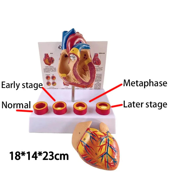 Simulatie Verwijderbaar anatomisch menselijk levensgroot hart Cardiovasculaire anatomie Trombotisch vasculair medisch model