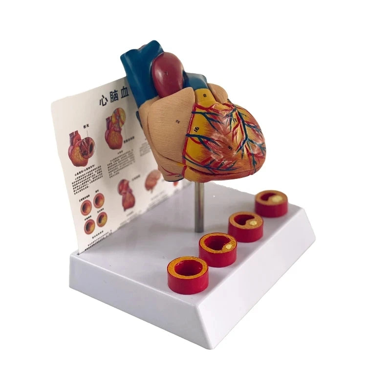 Simulation Removable Anatomical Human Life Size Heart Cardiovascular ...