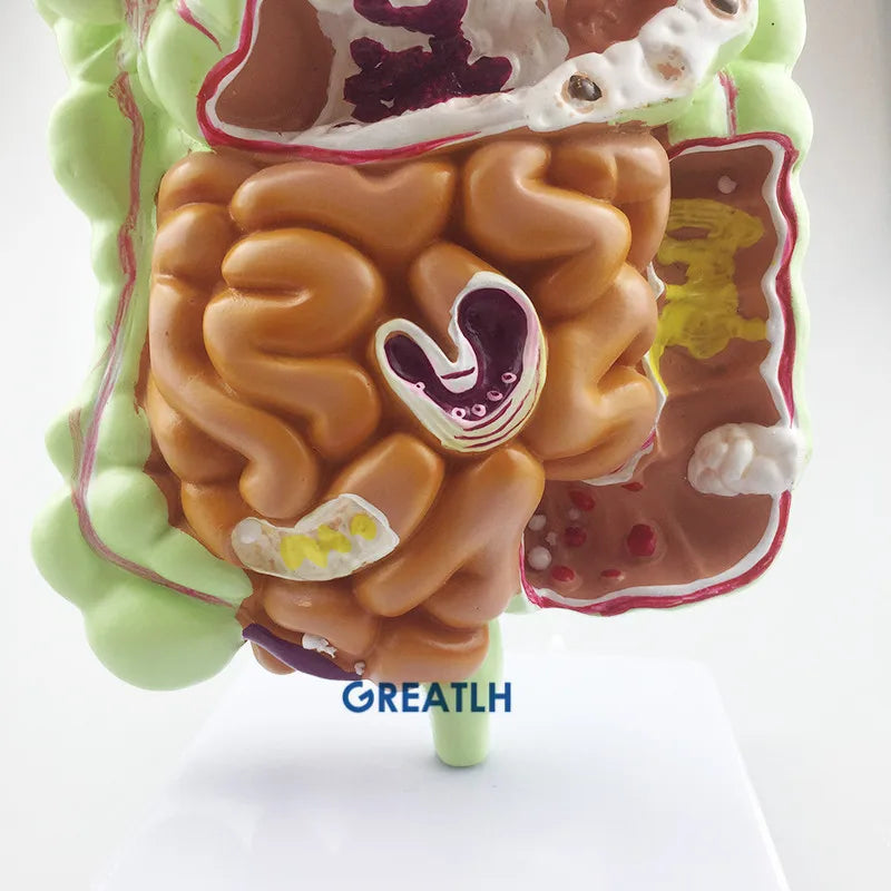 Modelo de anatomia retal do estômago, intestino grosso, sistema digestivo humano, modelo de ensino