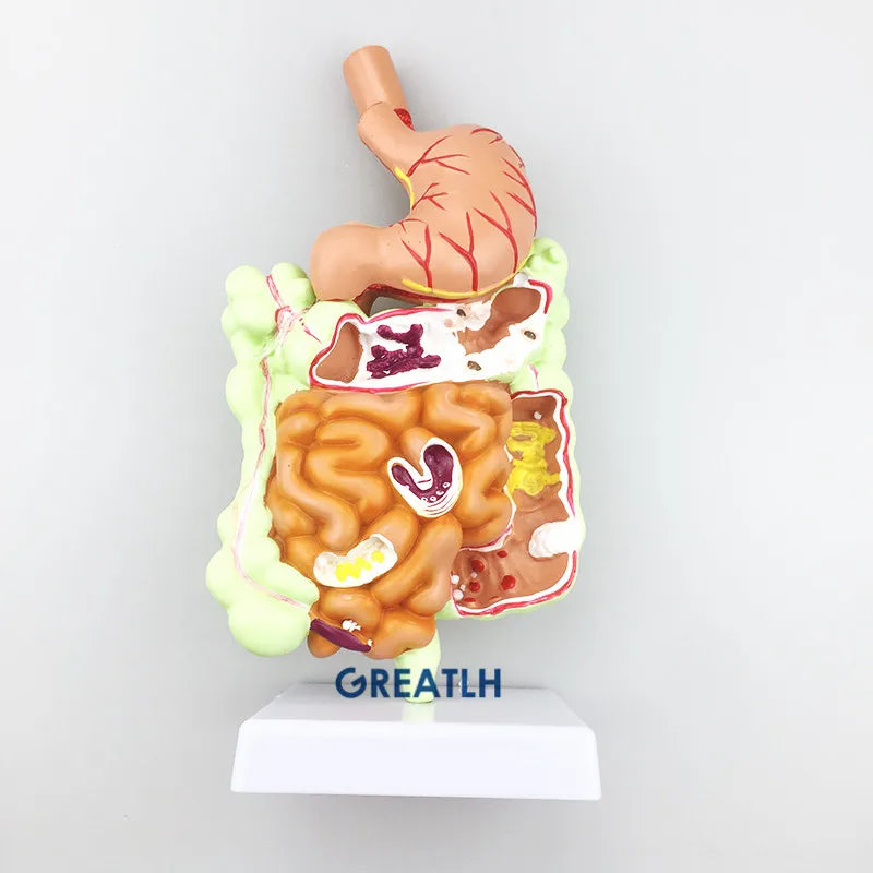 Modelo de anatomía rectal del intestino grueso del estómago, modelo de enseñanza del sistema digestivo humano