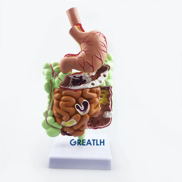 胃、大腸、盲腸、直腸の解剖学モデル 人間の消化器系の教育モデル