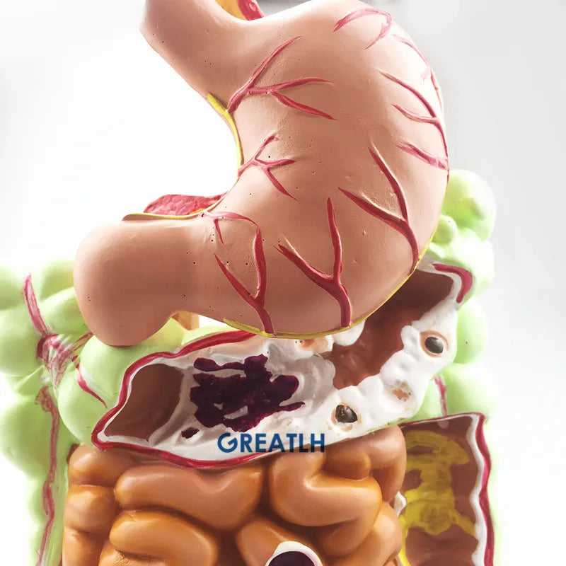 المعدة الأمعاء الغليظة الأعور المستقيم نموذج تشريح الجهاز الهضمي البشري نموذج للتدريس