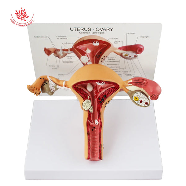 Modello di Utero Organi Riproduttivi Femminili Modello di Anatomia Patologica per Educazione Anatomica di Forestedu