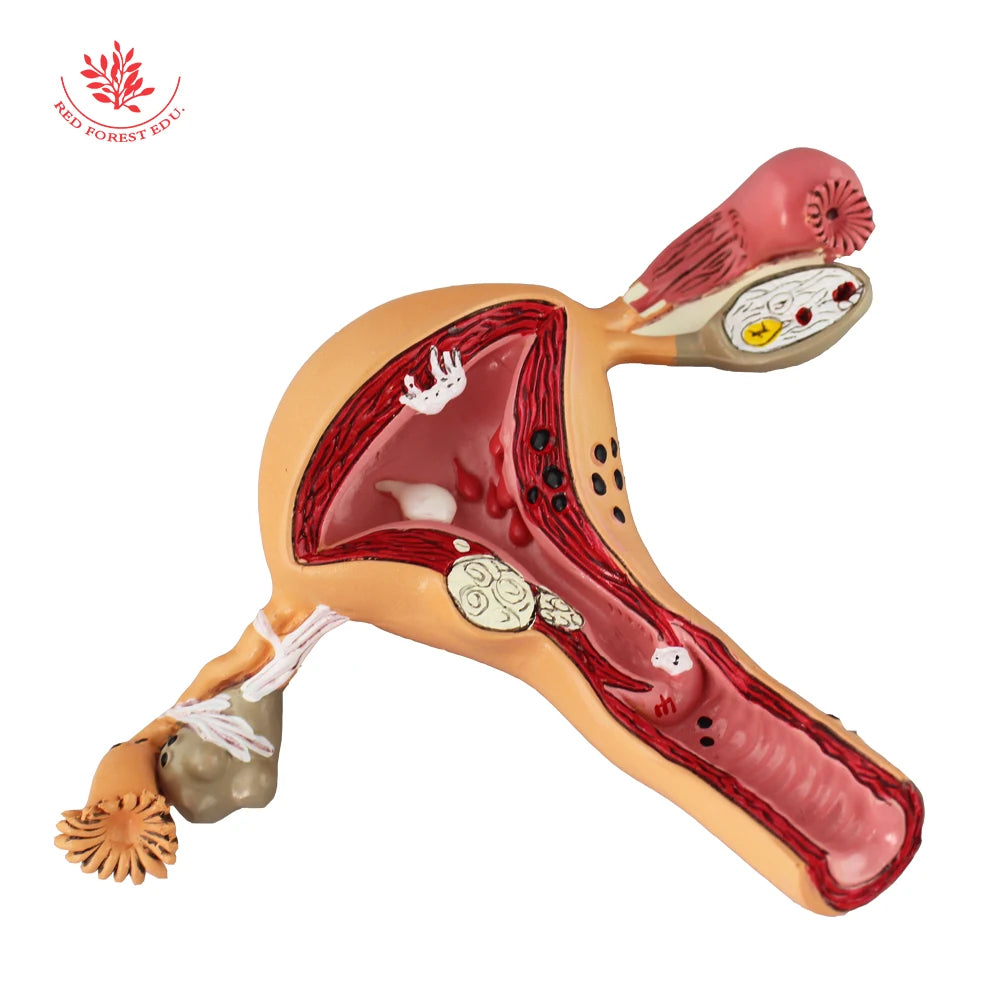 95%가 착각하는 '자궁'의 진짜 모습\u003e 여러분, 교과서에서 흔히 보던 '팔 벌린 나비' 모양의 자궁, 실제 우리 몸속 자궁과는 많이  다르다는 사실, 알고 계셨나요? 자궁은 골반 안쪽, 복막·직장·방광 사이에 빽빽하게 자리잡고 있고, 양팔처럼, image size:1000x1000