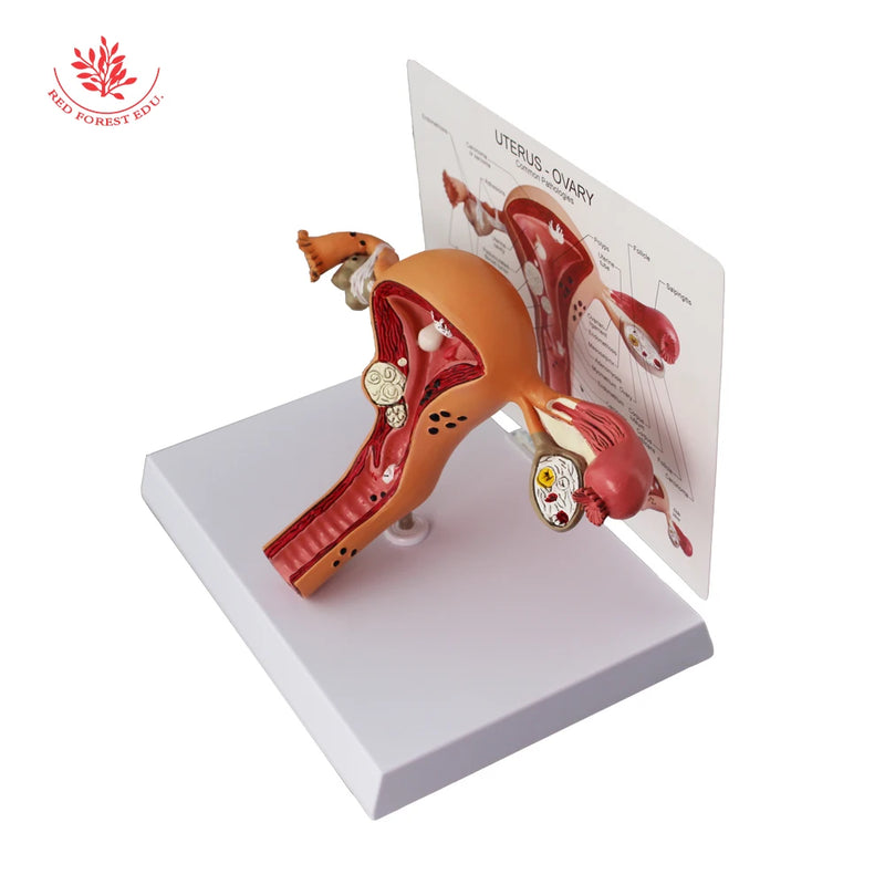 Model macicy Żeńskie narządy rozrodcze Model anatomiczny patologiczny do edukacji anatomicznej firmy Forestedu