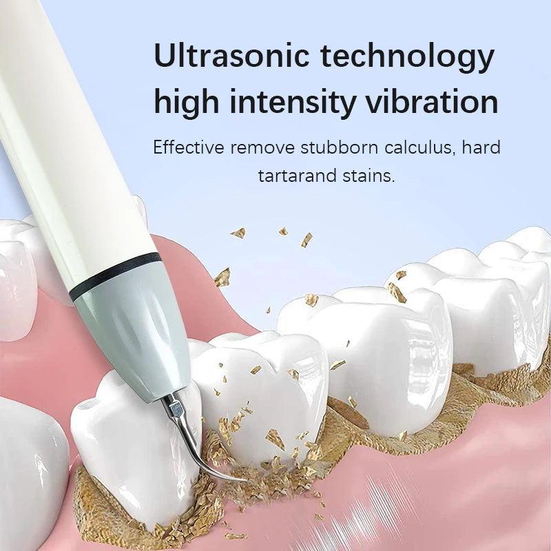 Experience Superior Oral Care with the Ultrasonic Dental Cleaner - Say ...