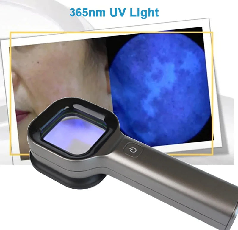 Lampada di Woods per l'analizzatore della pelle Lampada a raggi ultravioletti Esame della pelle UV Test di bellezza Analisi di ingrandimento del viso Lampada per vitiligine