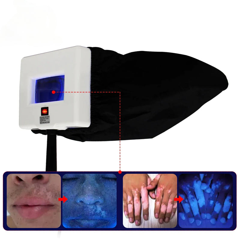 UV-analysator Houtlamp Gezichtshuidtesten Onderzoek Vergrootglas Beoordeling Grijsheid Tinea Machine Beauty SPA Salonapparatuur