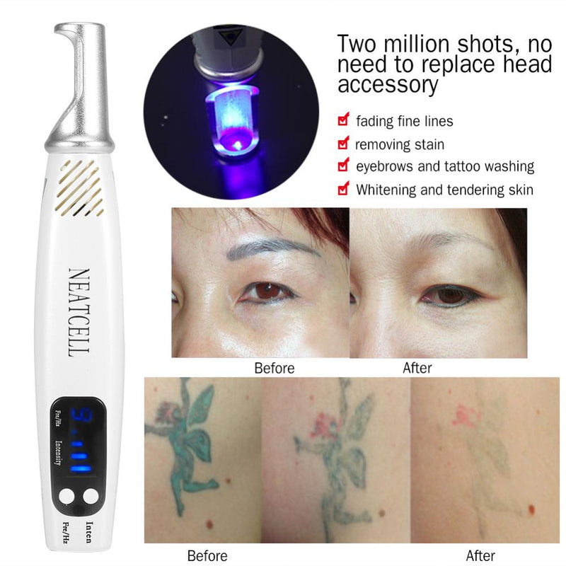 Picosecond Laser Pen Blått Ljusterapi Tatuering Ärr Mullvad Fräknar Borttagning av mörka fläckar Maskin Hudvård Skönhet Storbritannien EU USA AU Plugg