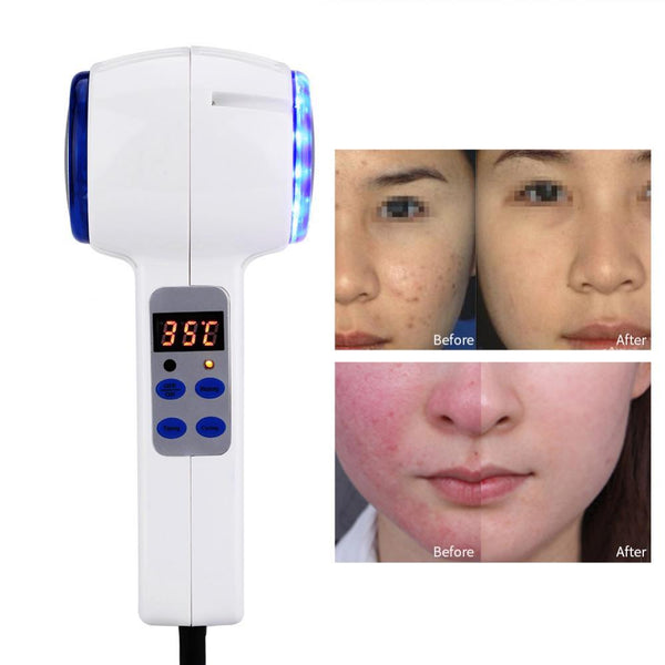 Dispositivo de cuidado facial Martillo frío y caliente Piel facial Apriete Crioterapia ultrasónica Fotón azul Acné Belleza de la piel Masajeador Salón de belleza