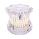 ترميم الأسنان باستخدام نموذج الزرع يوضح بعض الطرق: الزرع، جسر ميريلاند الثابت، التطعيم وغيرها.