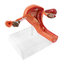 Penyakit ovarium dan rahim wanita Model diseksi Patologi model rahim pengajaran alat bantu medis manusia anatomi lesi rahim