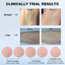 MLAY T4 Lazer Epilasyon Cihazı ICE Soğuk IPL Epilasyon 500000 Flaş IPL Ağrısız Kalıcı Epilasyon