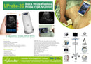 Wireless Ultrasound Probe
